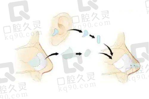 如何选择适合自己的超玛吉方案？