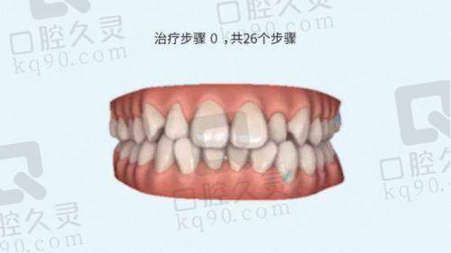 忻州恒伦口腔门诊：连锁品牌，收费亲民