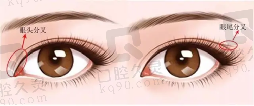 总结