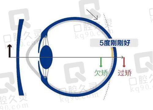 与其他来源信息中近视手术价格的对比