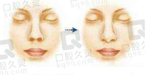 一、厦门修志夫整形怎么样？