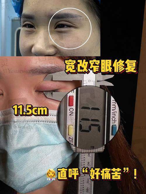 广州研媄荟医疗美容门诊部潘贰医生简介