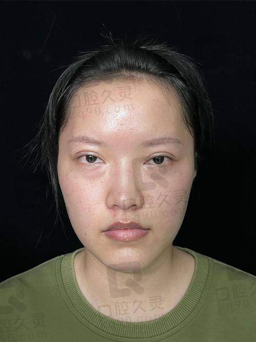 广州研媄荟医疗美容门诊部潘贰医生的真实的患者评价如下：