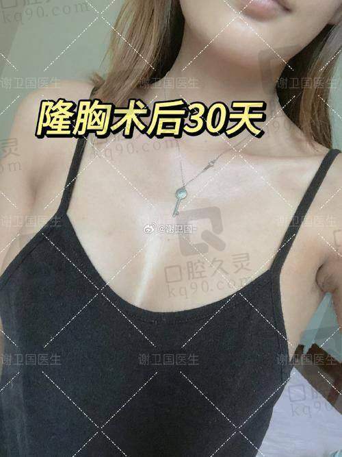总结：选择适合自己的胸假体品牌