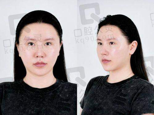 上海伊莱美医疗美容医院术前准备：严谨细致保安心