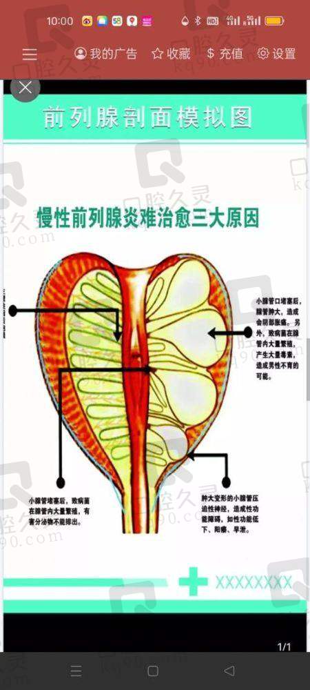 男科增粗手术多少钱？不同术式技术优势分析