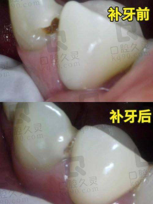就诊过程是怎样的？