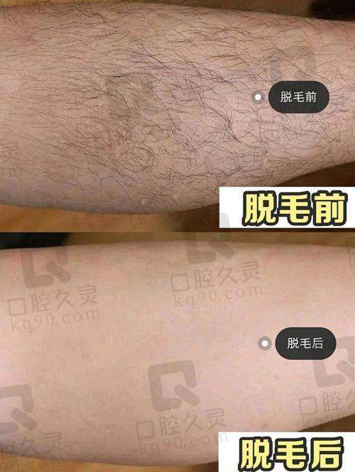 大连悦己时光医疗美容：专精团队，优质脱毛