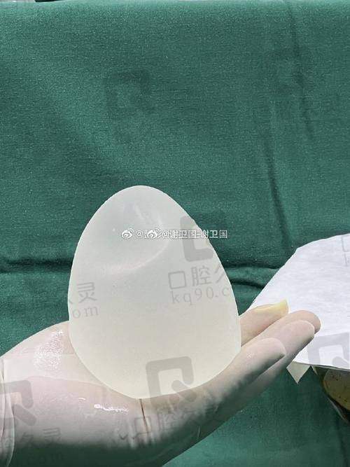 重庆美仑美奂假体隆胸技术有什么特色？