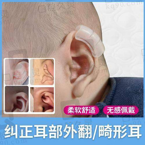 重庆美仑美奂毋巨龙耳畸形矫正的成效如何？