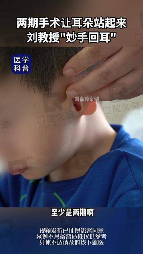 毋巨龙医生在耳畸形矫正领域有何优势？