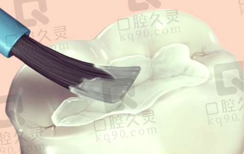 呼和浩特欧贝口腔做VOVO树脂补牙项目的具体优势