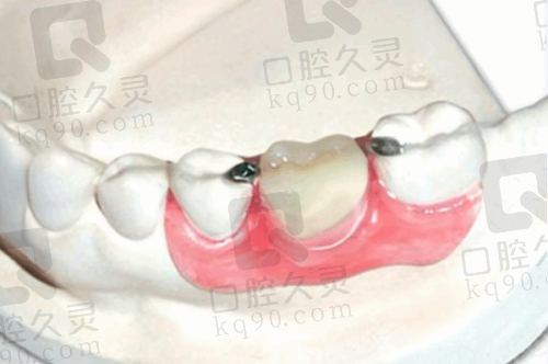 嘉兴英博口腔医院：正规靠谱的保护