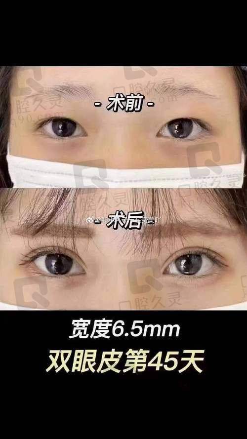 上海时光余东医生的技术优势