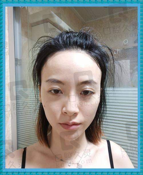 患者的真实口碑评价