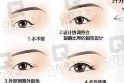 预约北京煤医周云超医生需要注意什么？