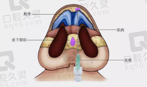 五、医生预约挂号攻略