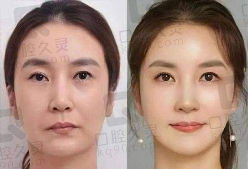 乐山达芬奇医疗美容刘宁医生预约方式