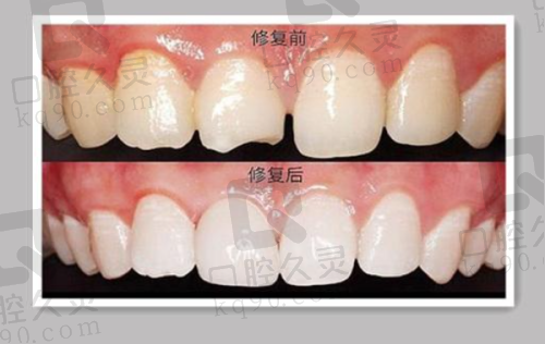 大连康贝佳口腔牙齿矫正的其他优势