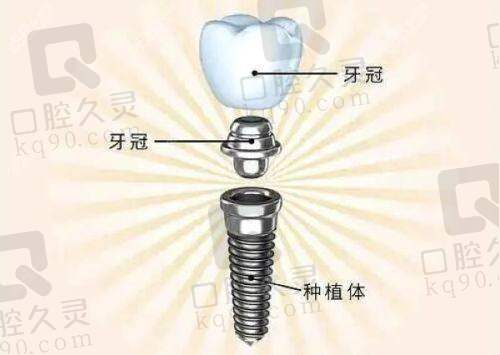 其他矫正项目及价格
