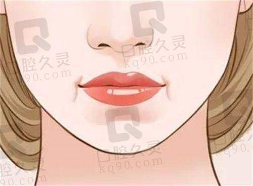 周云超医生擅长的异物取出类型有哪些？