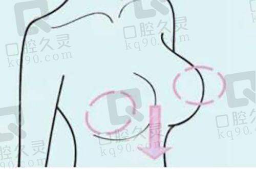 周云超取生长因子与其他医生相比有何优势？