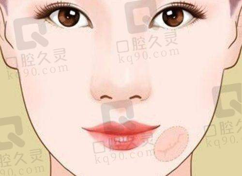 患者对周云超取生长因子的评价如何？