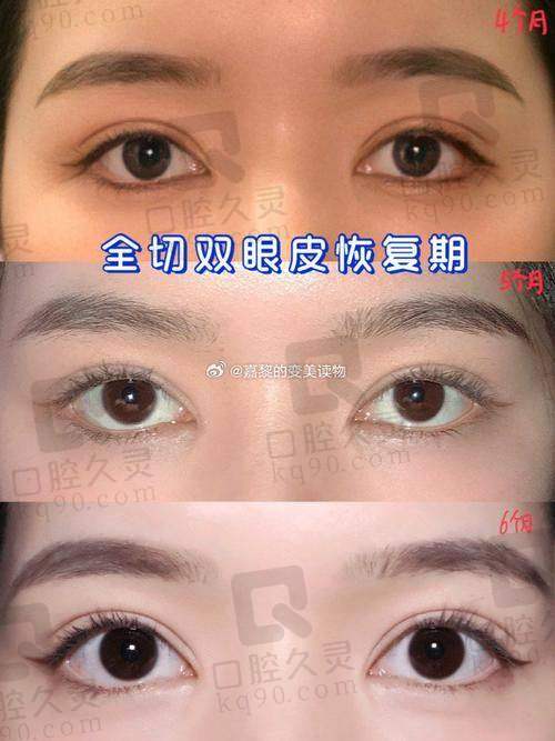 闫品行擅长什么项目？成功实例展示