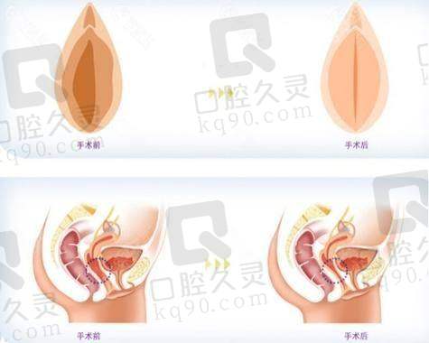 收费公开透明，口碑怎么样？