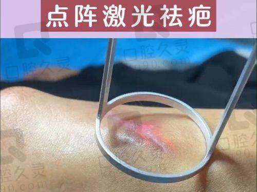 二、苏州乐桥疤痕医院的技术优势与医生团队