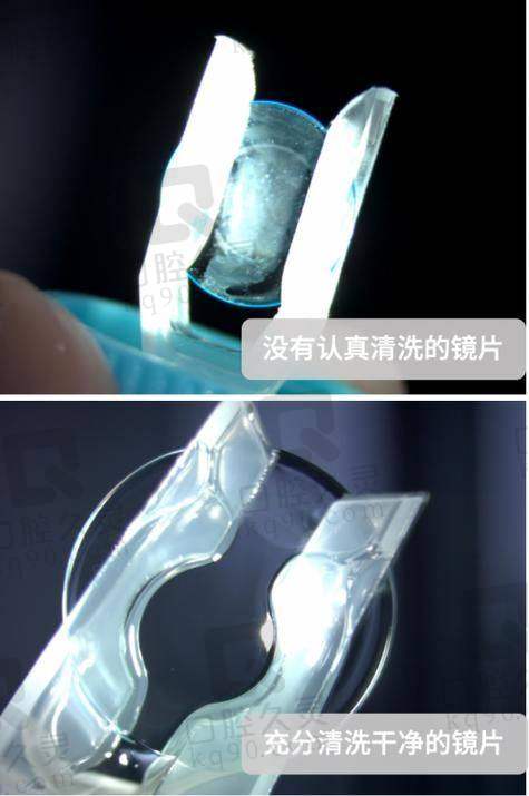 深圳普瑞眼科医院OK镜低至4800元起的优势