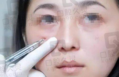 南京美莱医疗美容刘昭政特色技术优势