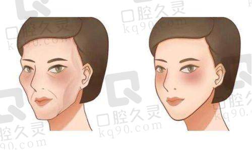 贵阳利美康做胸哪个医生口碑最好？鲁天宇、刘德东等医生值得了解