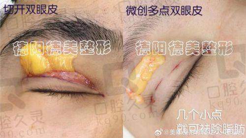 三、北京王博谦医生眼修复技术特色