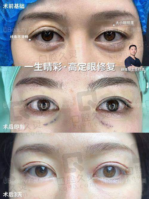 术后修复，成效逐渐显现