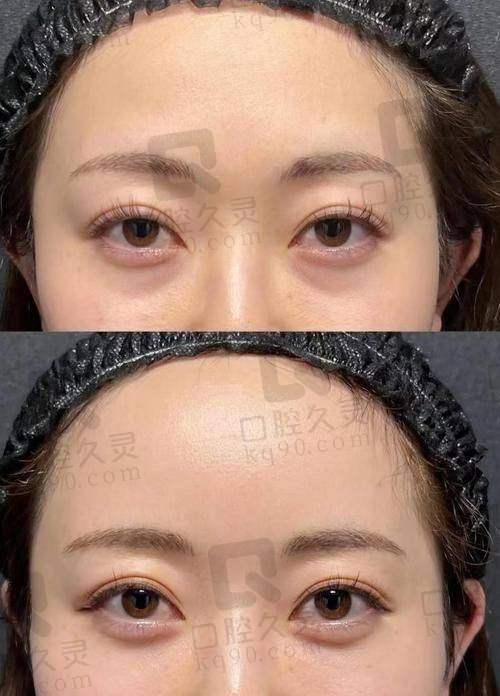 北京轻美颜祛眼袋医院的口碑评价与乘车路线