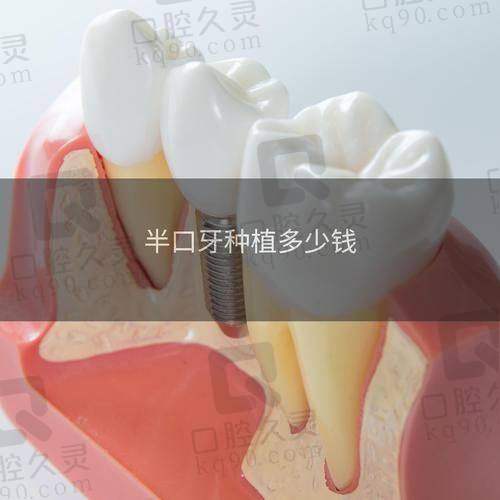 术后需要注意什么？