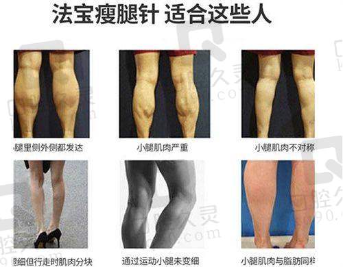 三、成都达拉斯医疗美容医院的患者实例分享