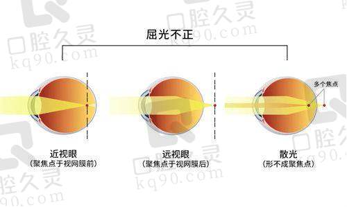 郑州巩义阳光医院眼科地址电话：