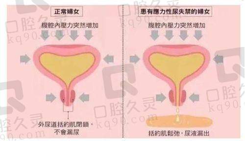 一、河南一科整形医院：河南整形行业的佼佼者