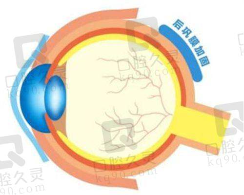 如何进行重庆佰视佳眼科医院赵小虎医生预约挂号？