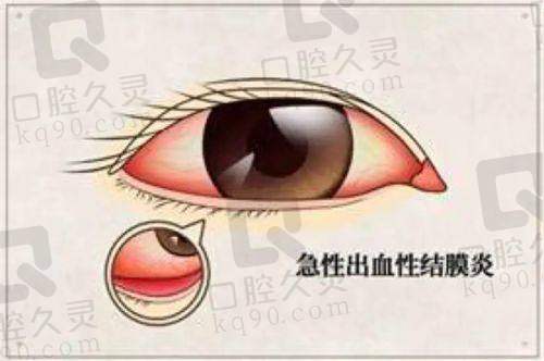 武汉普瑞眼科医院其他人气医生有谁？