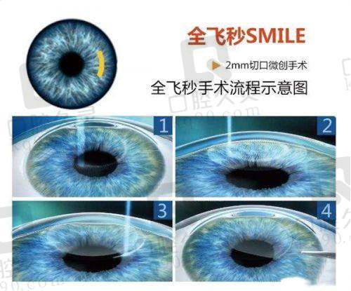 如何根据需求选择武汉普瑞眼科医院的医生？