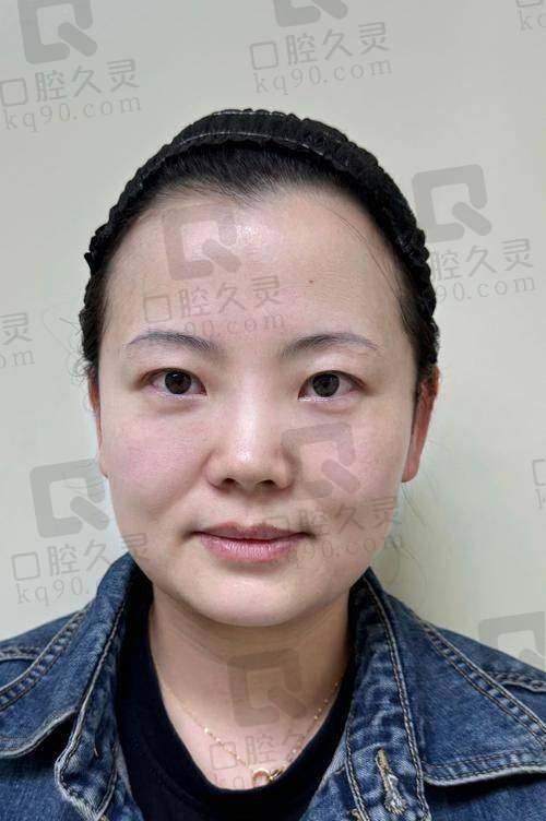 成都璞龄整形手术后服务体系：术后也安心
