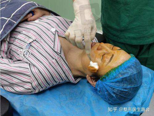二、黄海侠医生是不是网红医生呀——技术特色剖析