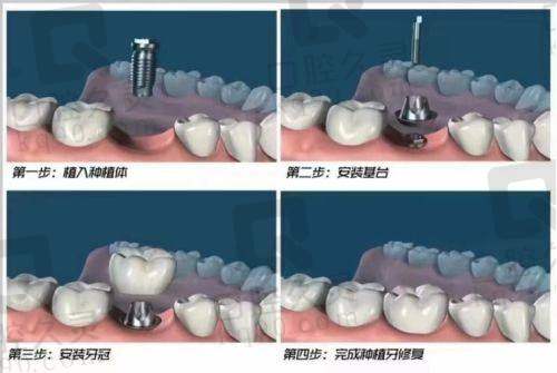 8. 石家庄普爱口腔 - 明亮舒适的就医体验