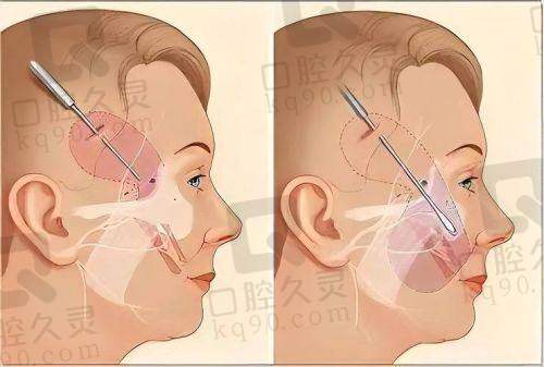 北京联合丽格第二医疗美容医院：王志军多点执业的专精平台