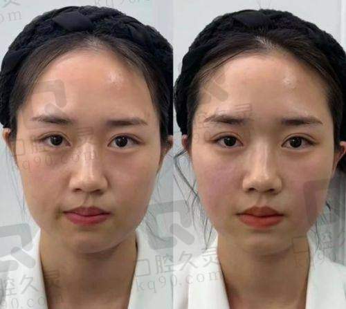 热玛吉美容店可以做吗？顾客评价不可忽视