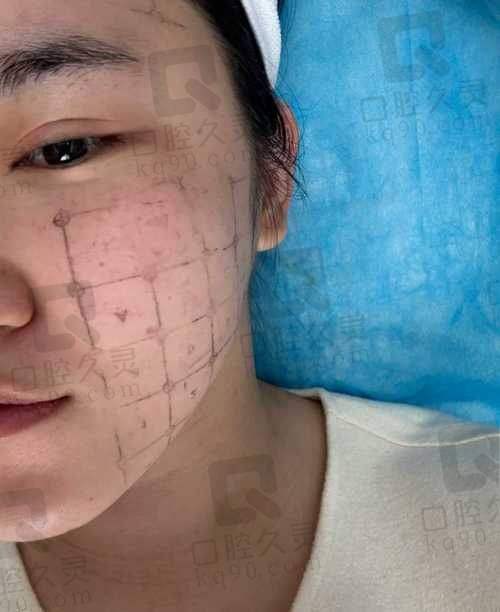 热玛吉美容店可以做吗？专精认证至关重要