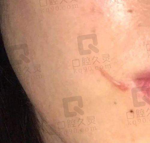 苏州乐桥疤痕研究院能用医保吗？医保报销及收费标准解析，值得信赖的疤痕治疗专科医院